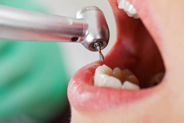 Best Emergency Broken Tooth Repair in Unionville, TN